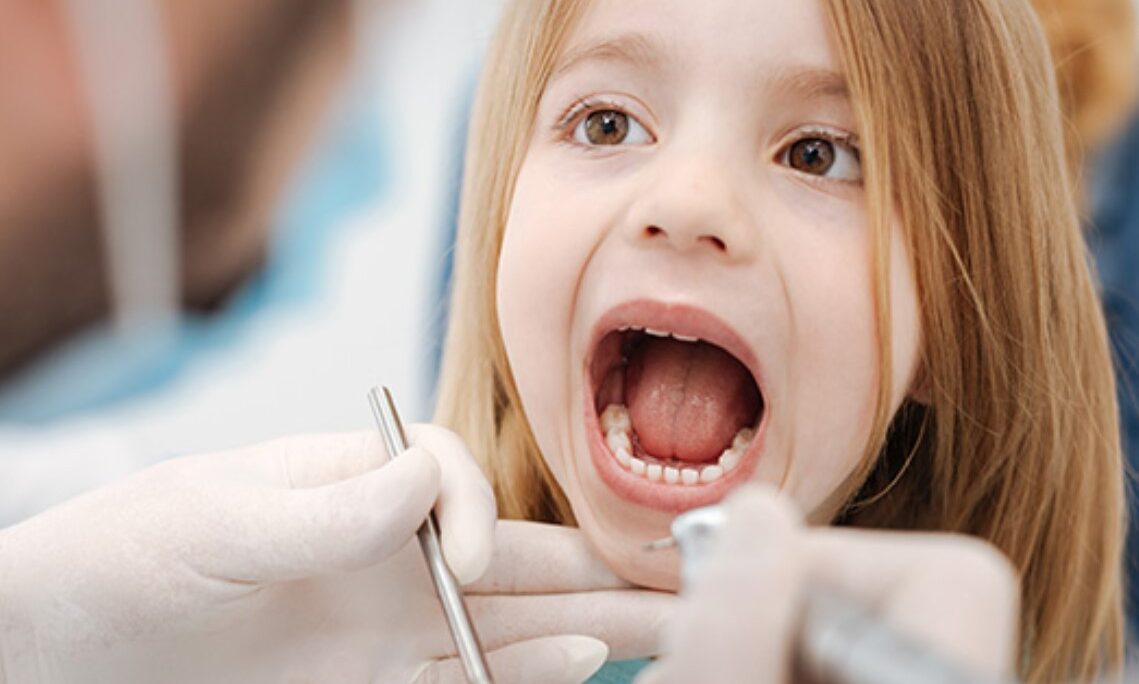 Kids dental cavity filling