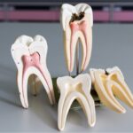 Root Canal Recovery Timeline