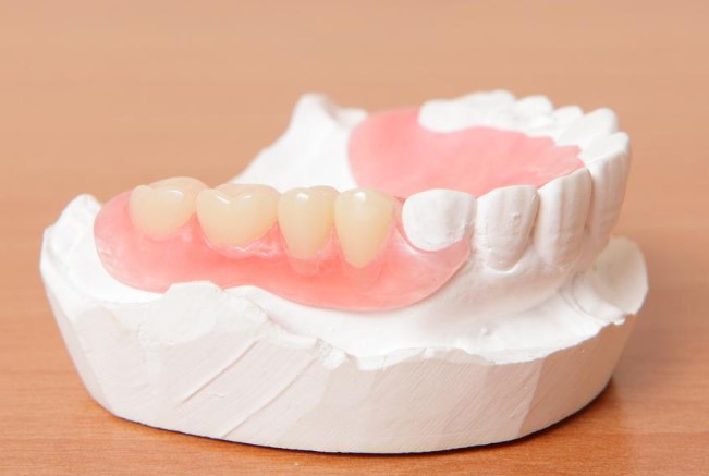 how long do dentures last