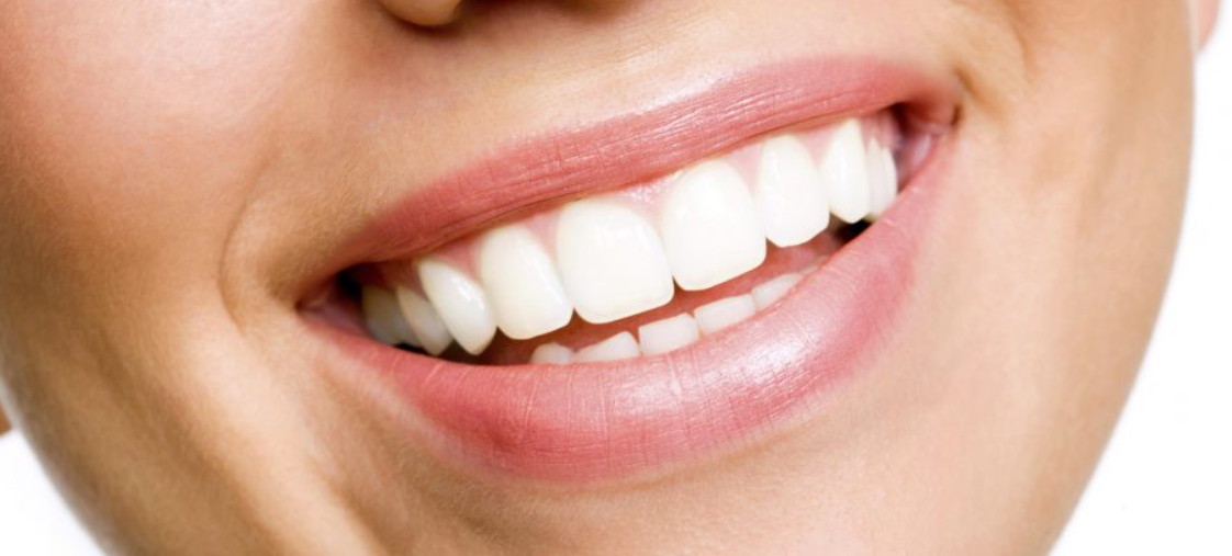 How Much Does Teeth Whitening Cost