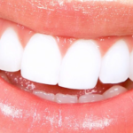 Pictures of Partial Dentures Front Teeth