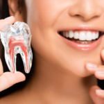 How does a single tooth denture stay in?