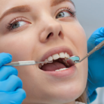 Root canal cost Ontario