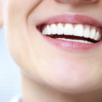 Professional teeth whitening