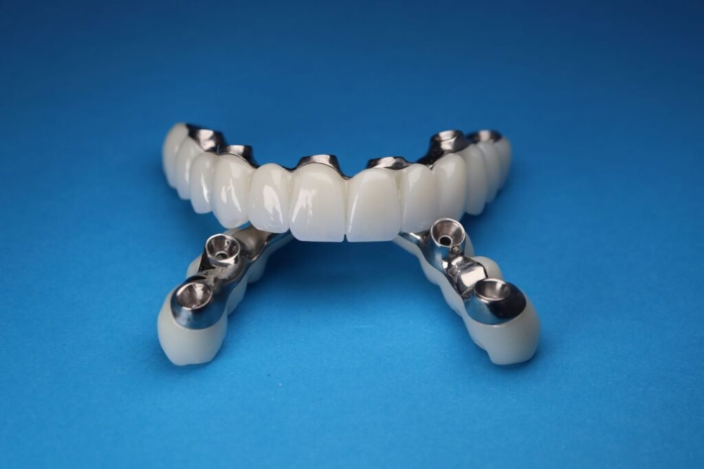 Dental implant posts, abutments and crowns for tooth replacement in Woodbridge