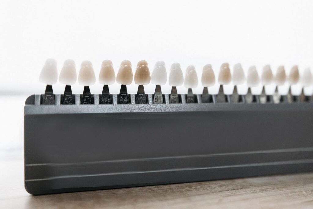 Detailed view of dental restorations used for cosmetic smile design