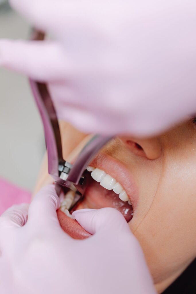 Emergency tooth extraction at a dental clinic in Woodbridge