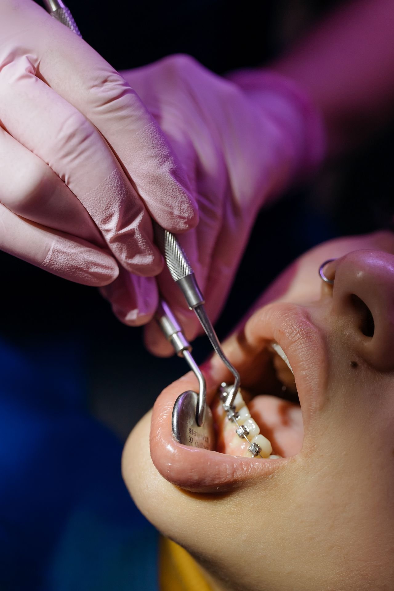 Dentist adjusting braces on a patient