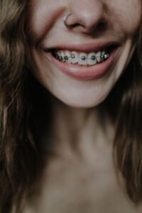 Smiling woman showing her teeth braces