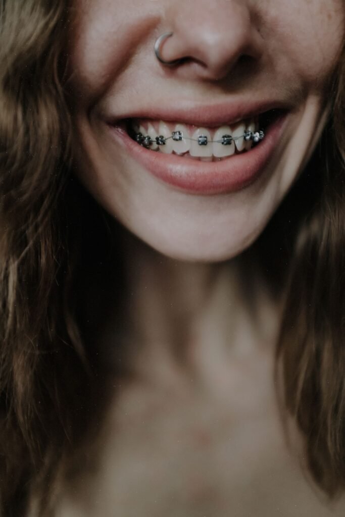 Smiling woman showing her teeth braces