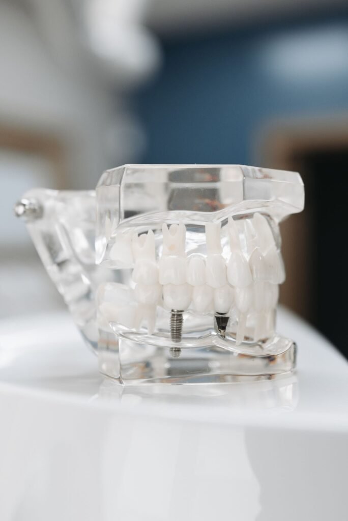 Transparent dental model showing implants supporting teeth