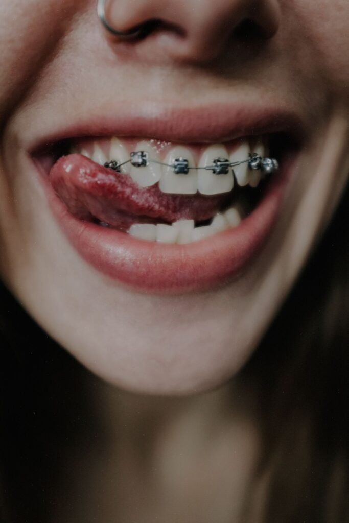 Smiling woman with orthodontic treatment to correct her bite
